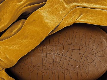 kapinice, akácie (Acacia cyclops) – detail povrchu semene s masíčkem, foto Viktor Sýkora